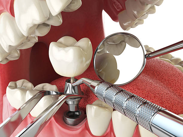 Best Emergency Treatment for Oral Infections in Queen Creek, AZ